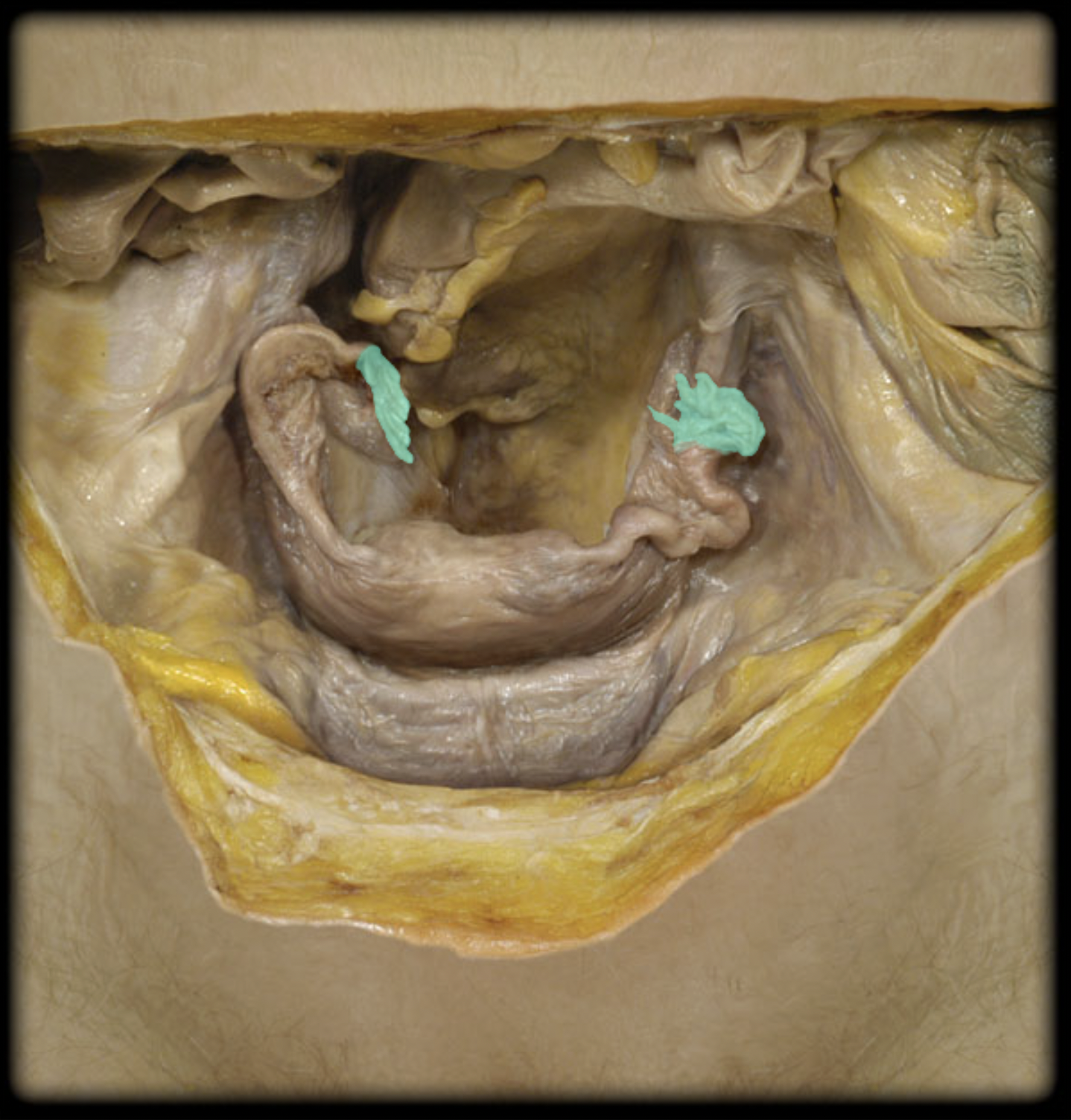 <p>What structure is shown?</p>