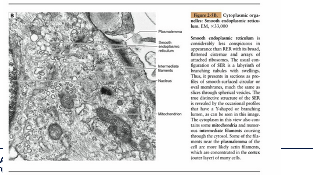 <p><strong>Smooth Endoplasmic Reticulum Characteristics:</strong> Smooth endoplasmic reticulum is considerably less conspicuous in appearance than RER with its broad, flattened cisternae and arrays of attached ribosomes. The usual configuration of SER is a labyrinth of branching tubules with swellings. Thus, it presents in sections as profiles of smooth-surfaced circular or oval membranes, much the same as slices through spherical vesicles. The true distinctive structure of the SER is revealed by the occasional profiles that have a Y-shaped or branching lumen, as can be seen in this image.</p><p><strong>Cytoplasmic Contents:</strong> The cytoplasm in this view also contains some mitochondria and numerous intermediate filaments coursing through the cytosol. Some of the filaments near the plasmalemma of the cell are more likely actin filaments, which are concentrated in the cortex (outer layer) of many cells.</p>
