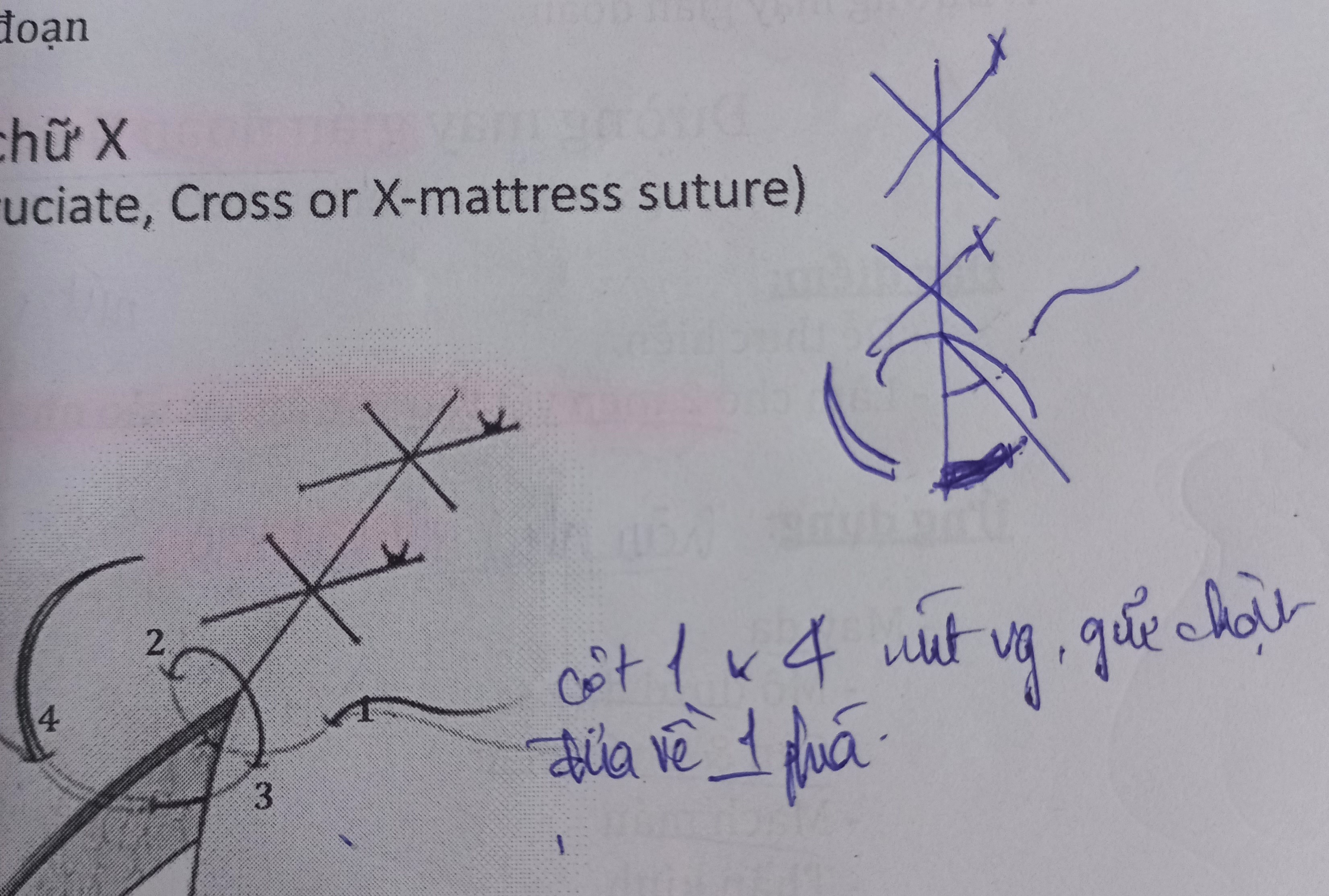 <p>Đường may chữ x</p>