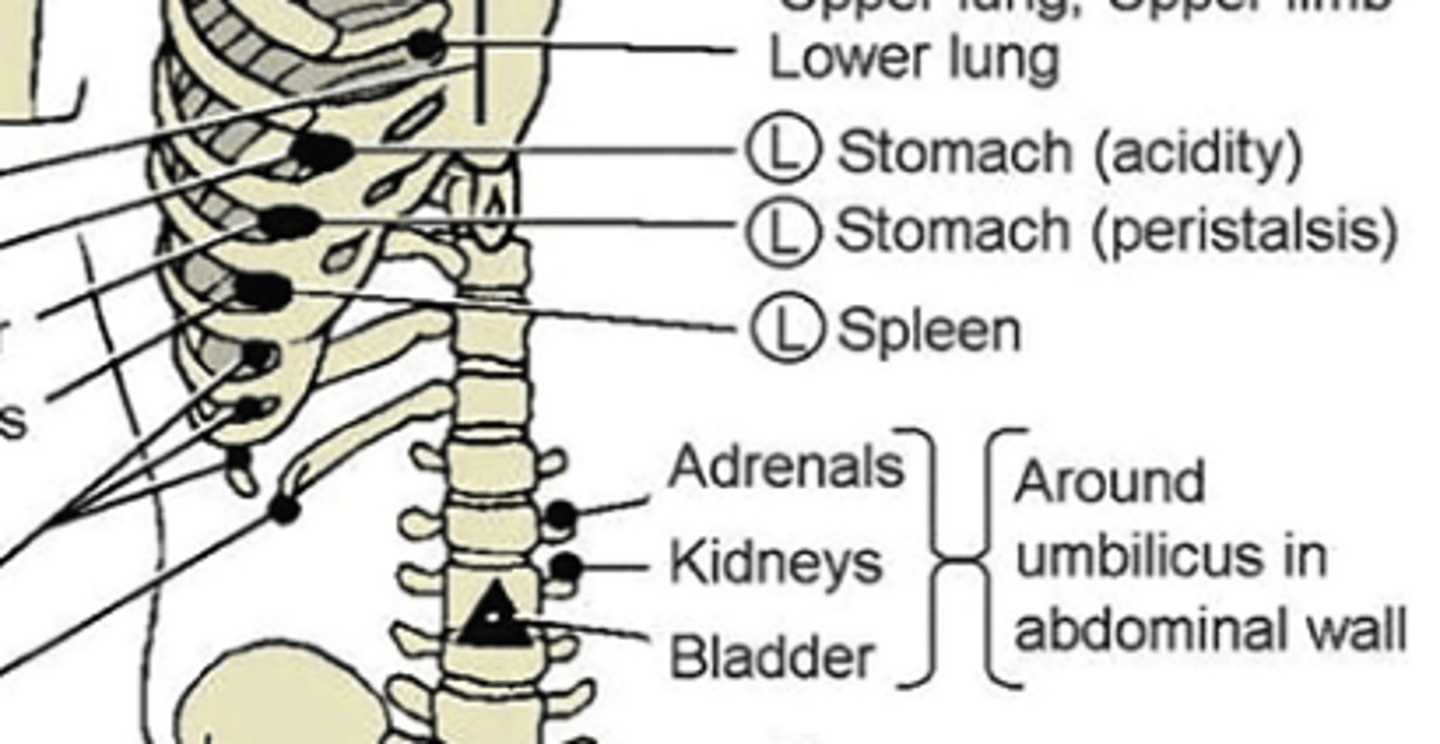 <p>anterior: 1 in lateral and 2 in superior to umbilicus (ipsilateral)</p><p>posterior: T11-T12 (ipsilateral)</p>
