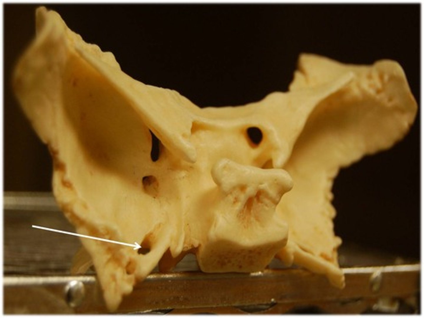 <p>Located posterior to the foramen rotundum on each side, approximately in line with the dorsum sellae in endocranial view</p>