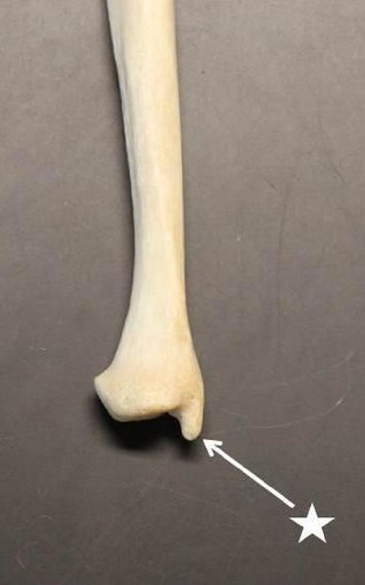 <p>ID specific part of ulna</p>