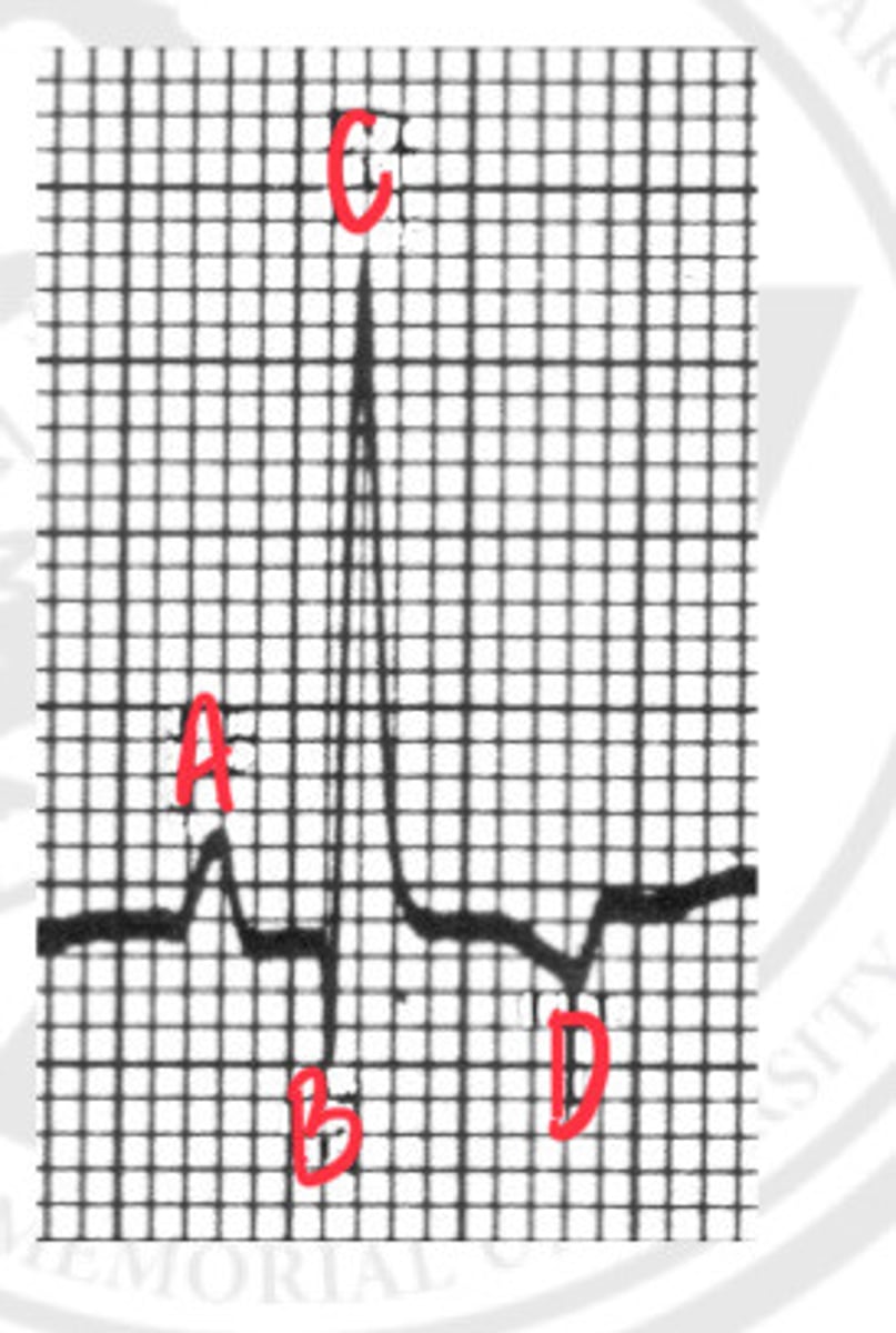 <p>What is D?</p>