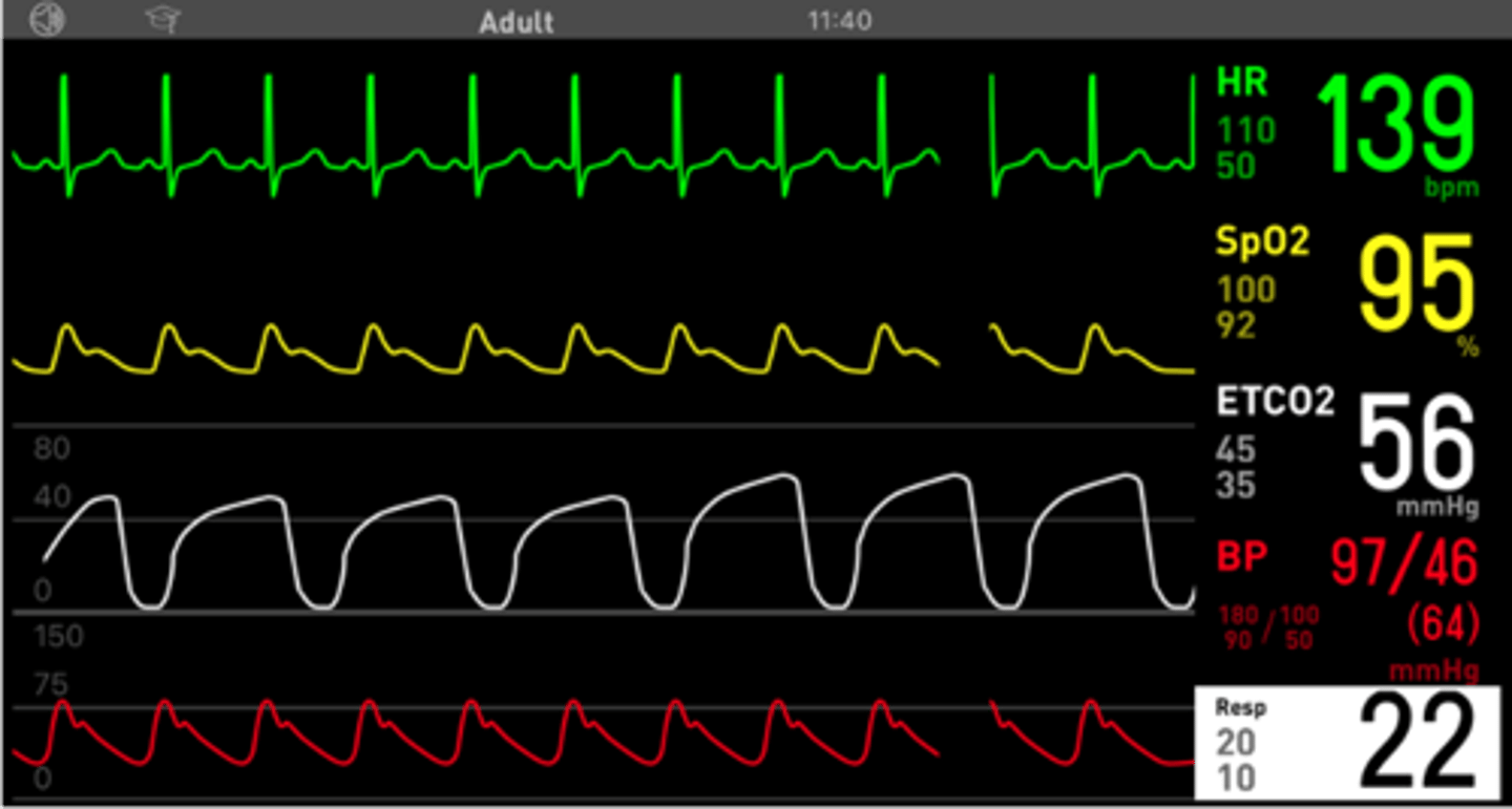 <p>Suggest the endotracheal tube is suctioned or replaced</p>