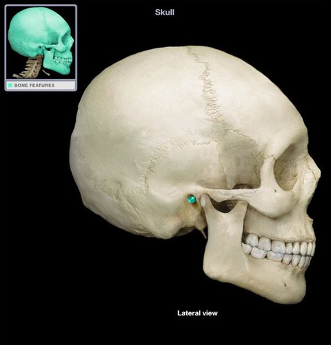 <p>Temporal bone</p>