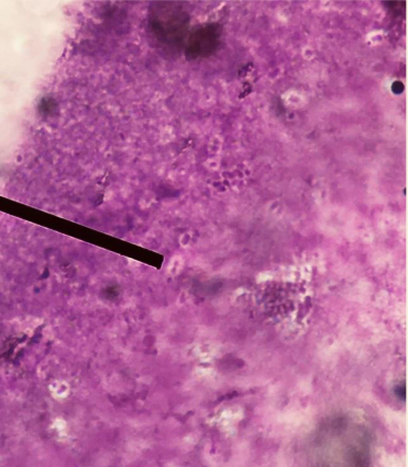 <p>Identify the morphology of the organism pointed at.</p>