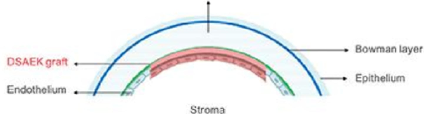 <p>Explain the process of DSAEK.</p>