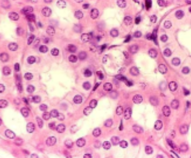 <p>What kind of epithelial tissue is this?</p>