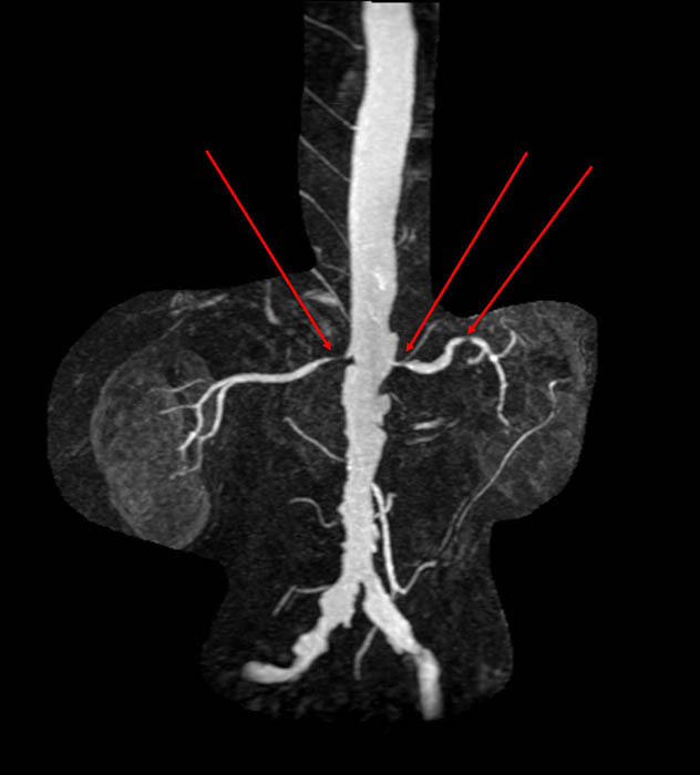 term image