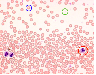 <p>What type of blood cell indicated by the blue circle?</p>