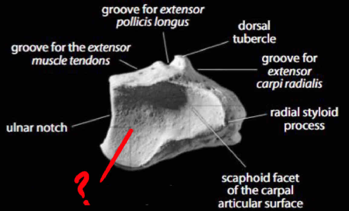 term image