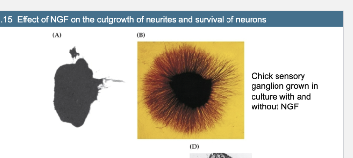 <p><span>Figure 23.15- Effect of NGF on the outgrowth of neurites and survival of neurons</span></p><p><span>Figure A vs Fig B</span></p>