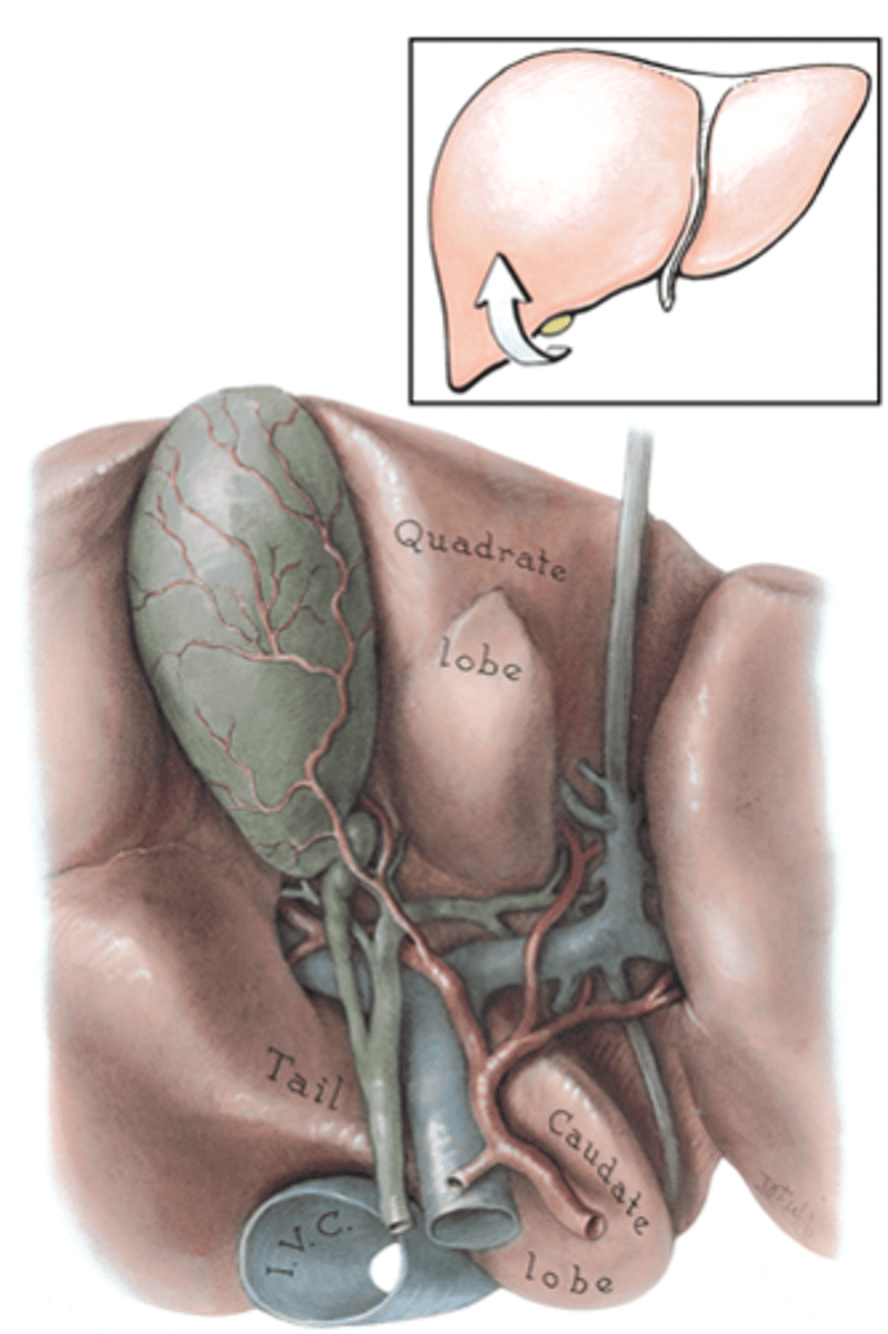 <p>Hilum of liver (transverse hepatic fissure) - contains components of hepatic artery, hepatic ducts and portal vein.</p><p>region of structures entering and exiting the liver</p>