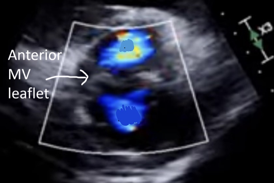 <p>Which is MR and which is AI</p>