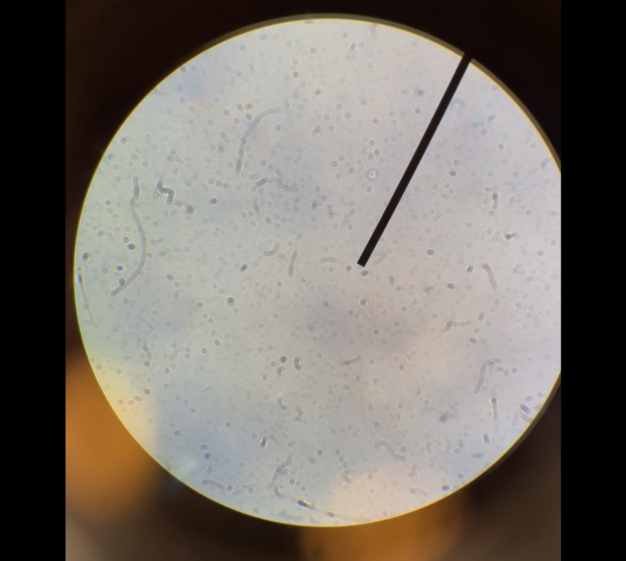 <p>What shape is this bacteria?</p>