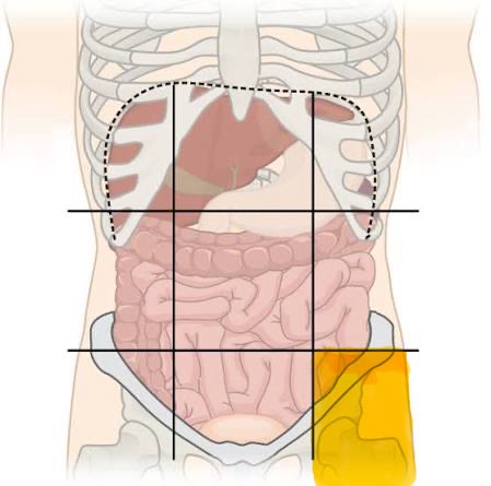 <p>descending colon, sigmoid colon</p>