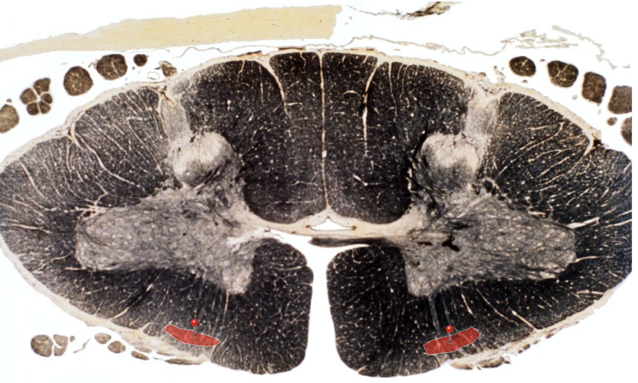 <p>Identify &amp; What Spinal cord level is this?</p>