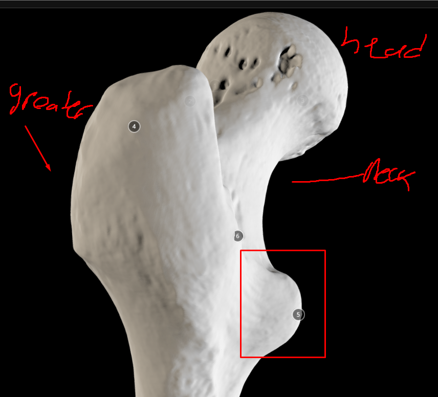 <p>lesser trochanter - smaller bump at the bottom of the neck of femur</p>