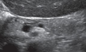 <p>What does the white arrow point to?</p>