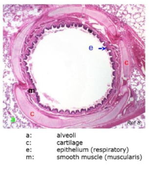 <p>what do we see in the bronchi structure that’s not in the trachea</p>