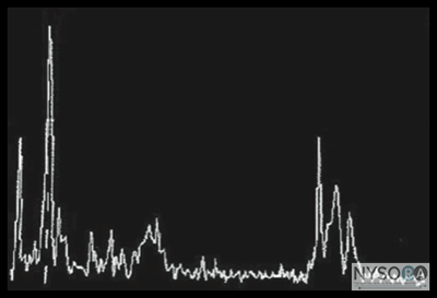<p>1 dimension - axial to beam</p><p>Spike on monitor indicates relative echogenicity - higher amplitude = stronger reflector</p><p>Based on range equation</p>