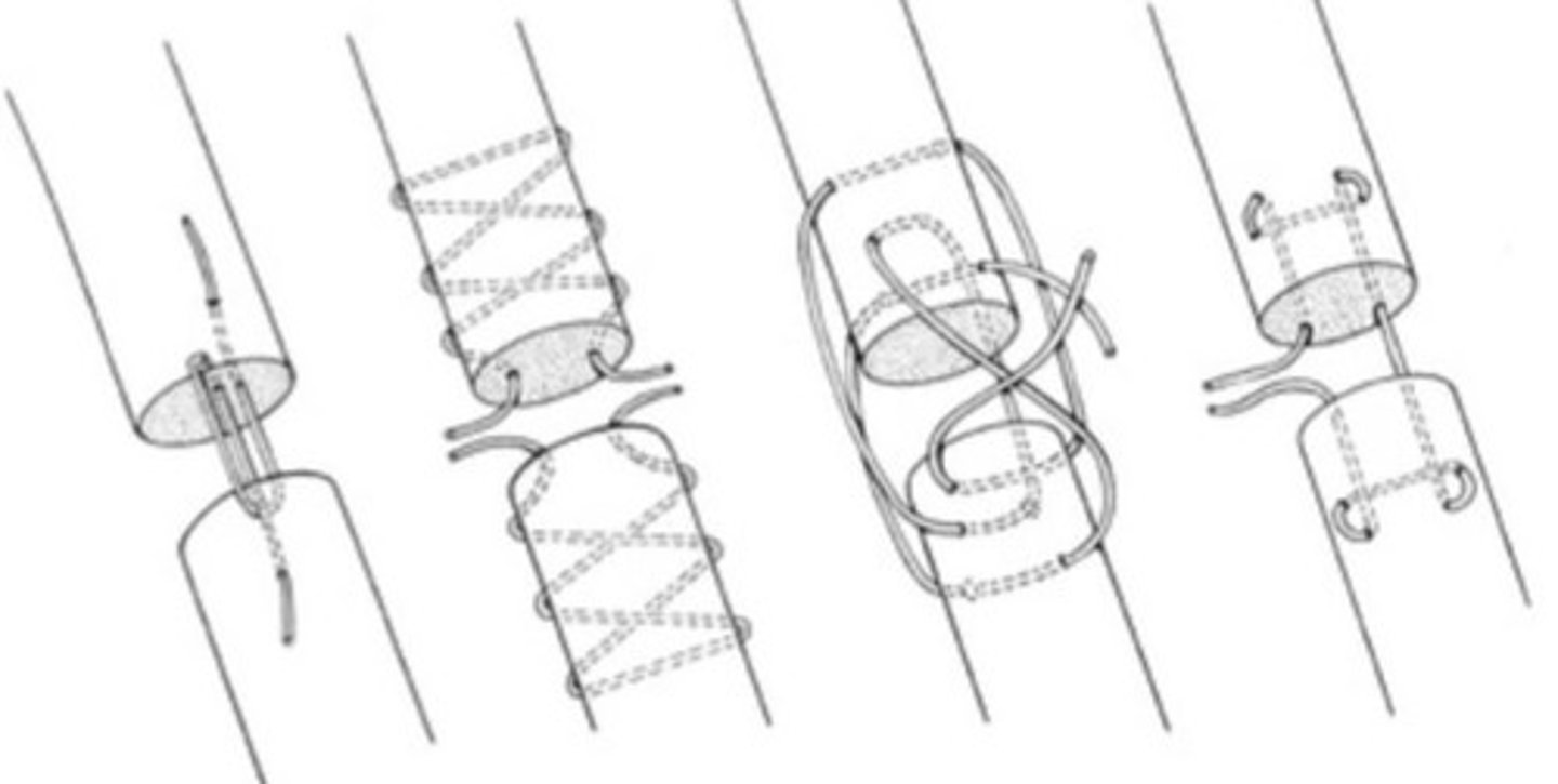 <p>If tendon is lacerated, how do we fix it?</p><p>Post-op care?</p>