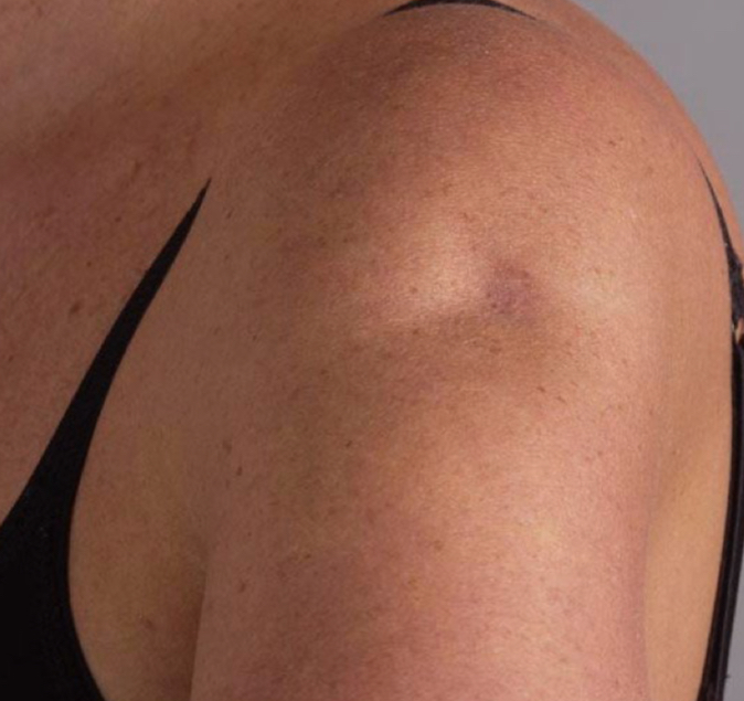 <p>what condition is depicted</p>