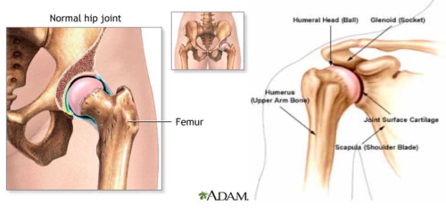 <p>What type of joint is this?</p>