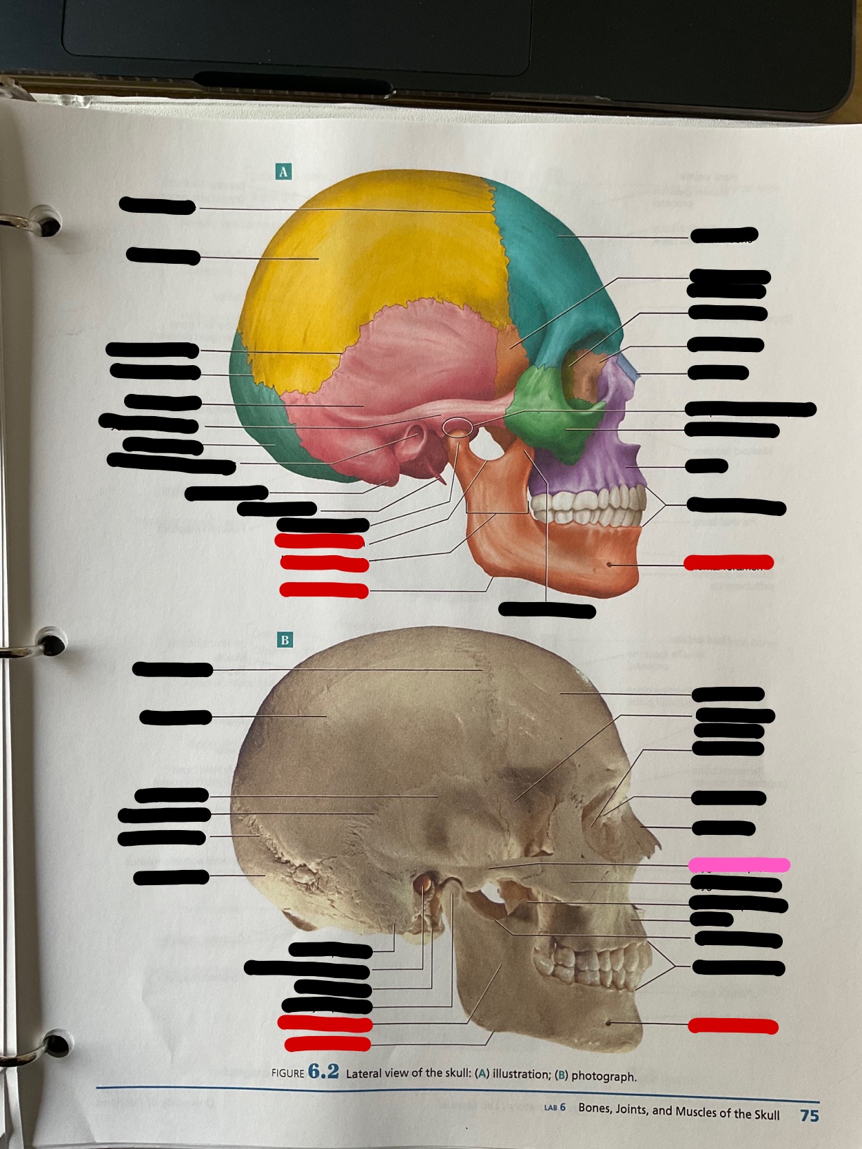 What bone feature is this?