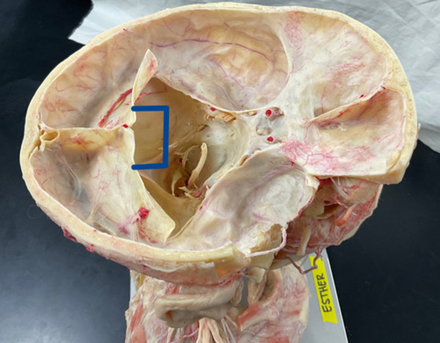 knowt flashcard image