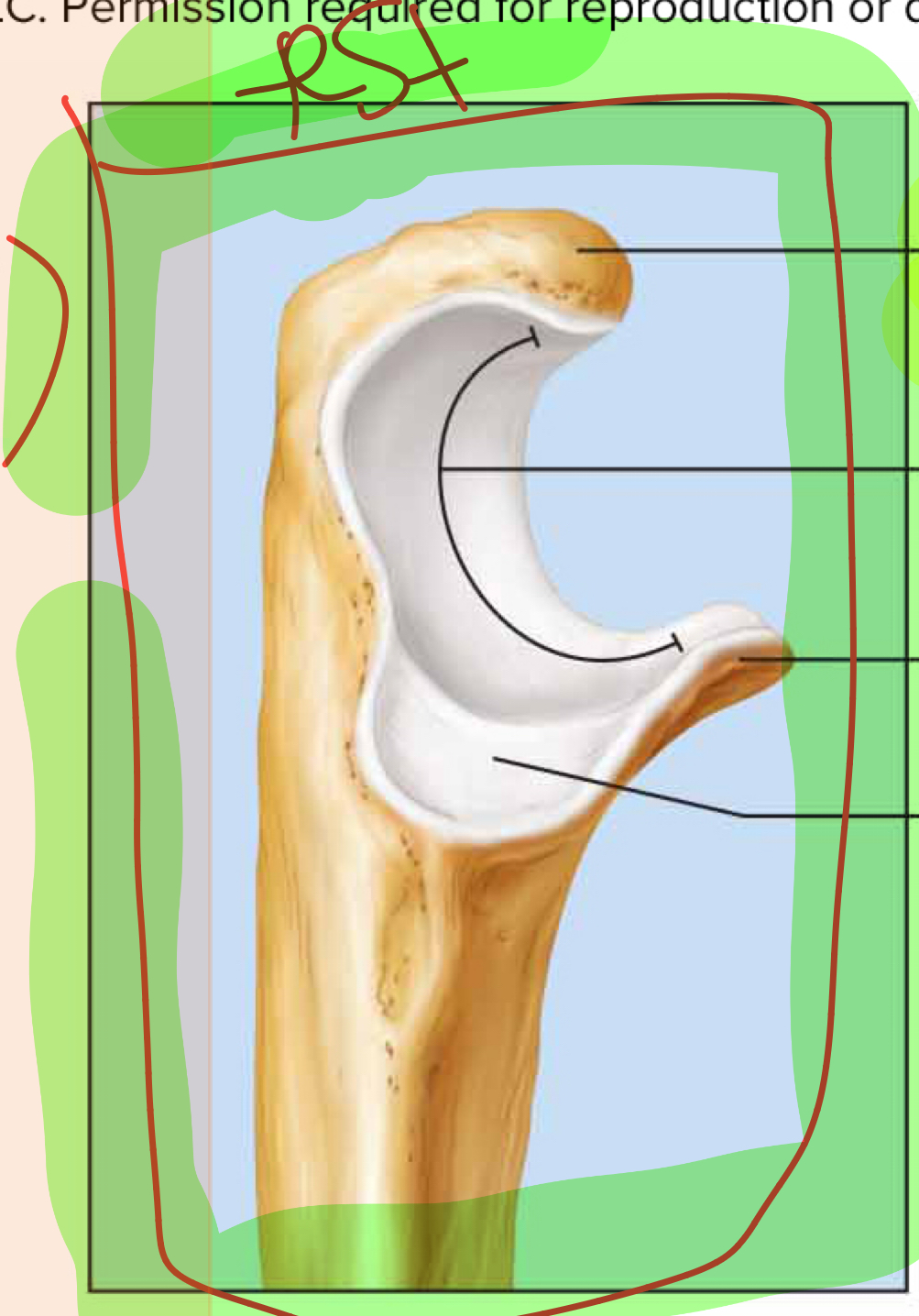 <p>What bone is this?</p>