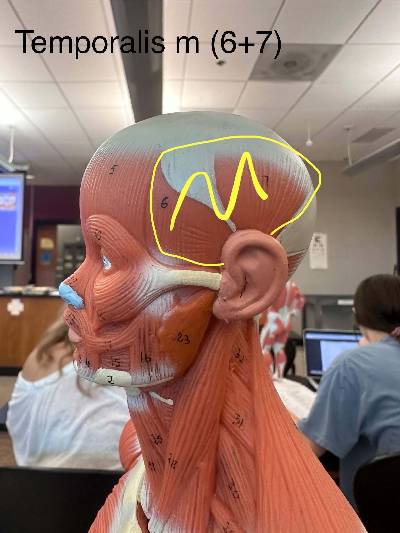 <p>Temporalis muscle. This muscle closes the jaw.</p><ul><li><p>The origin is the temporal fossa. </p></li><li><p>The insertion is the coronoid process of the mandible via a tendon that passes deep into the zygomatic arch.</p></li></ul>