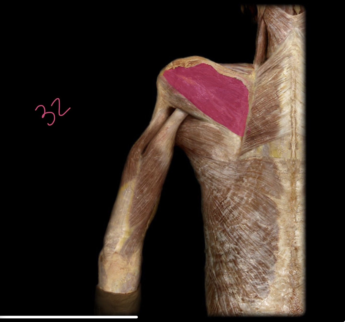 <p>Infraspiantus</p>
