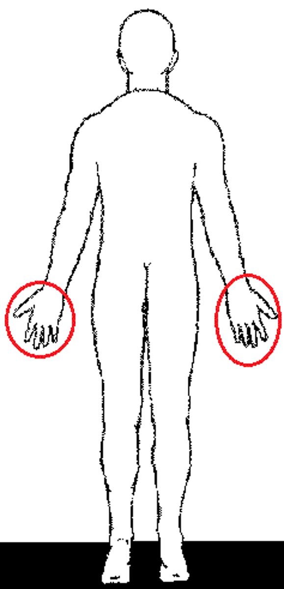 <p>palma (palm)<br>pollex (thumb)<br>digits (fingers)</p>