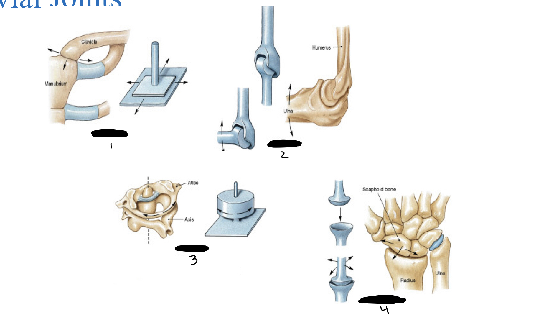 <ol><li><p>gliding joint</p></li><li><p>hinge joint</p></li><li><p>pivot joint</p></li><li><p>ellipsoidal joint</p></li></ol>