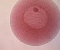 <p>stage 1; appears as a large cell with a clear nucleus and nucleolus</p>