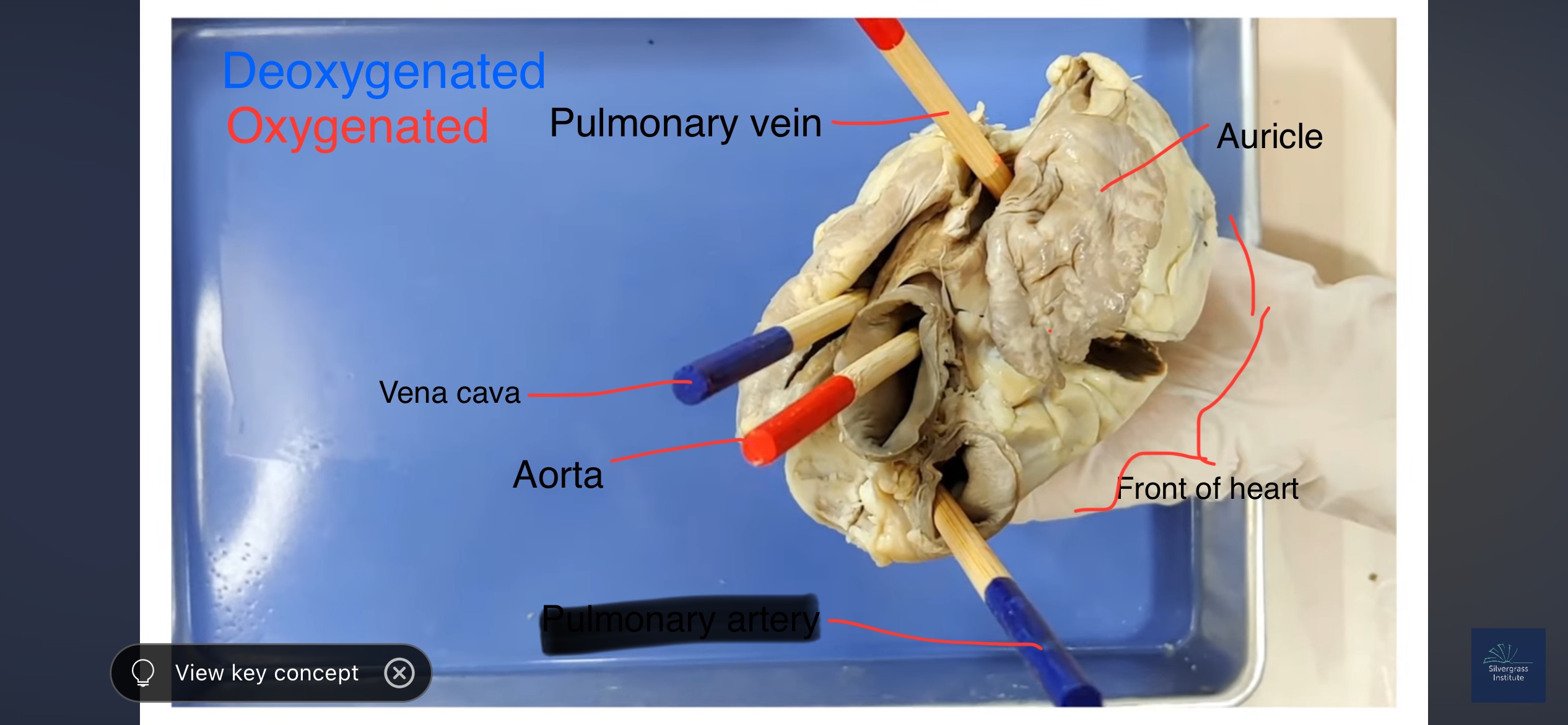 <p>Bring blood to lungs</p>
