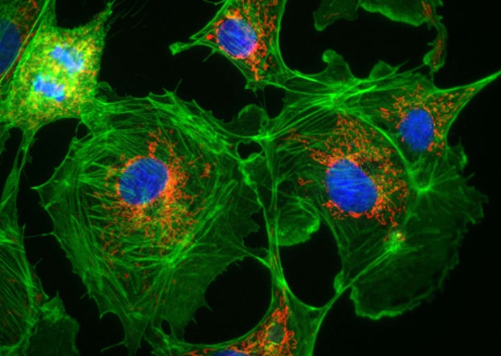 <p>Pros: Separate parts of a cell can be individually labeled</p><p>Cons: Fluorescence is temporary</p>