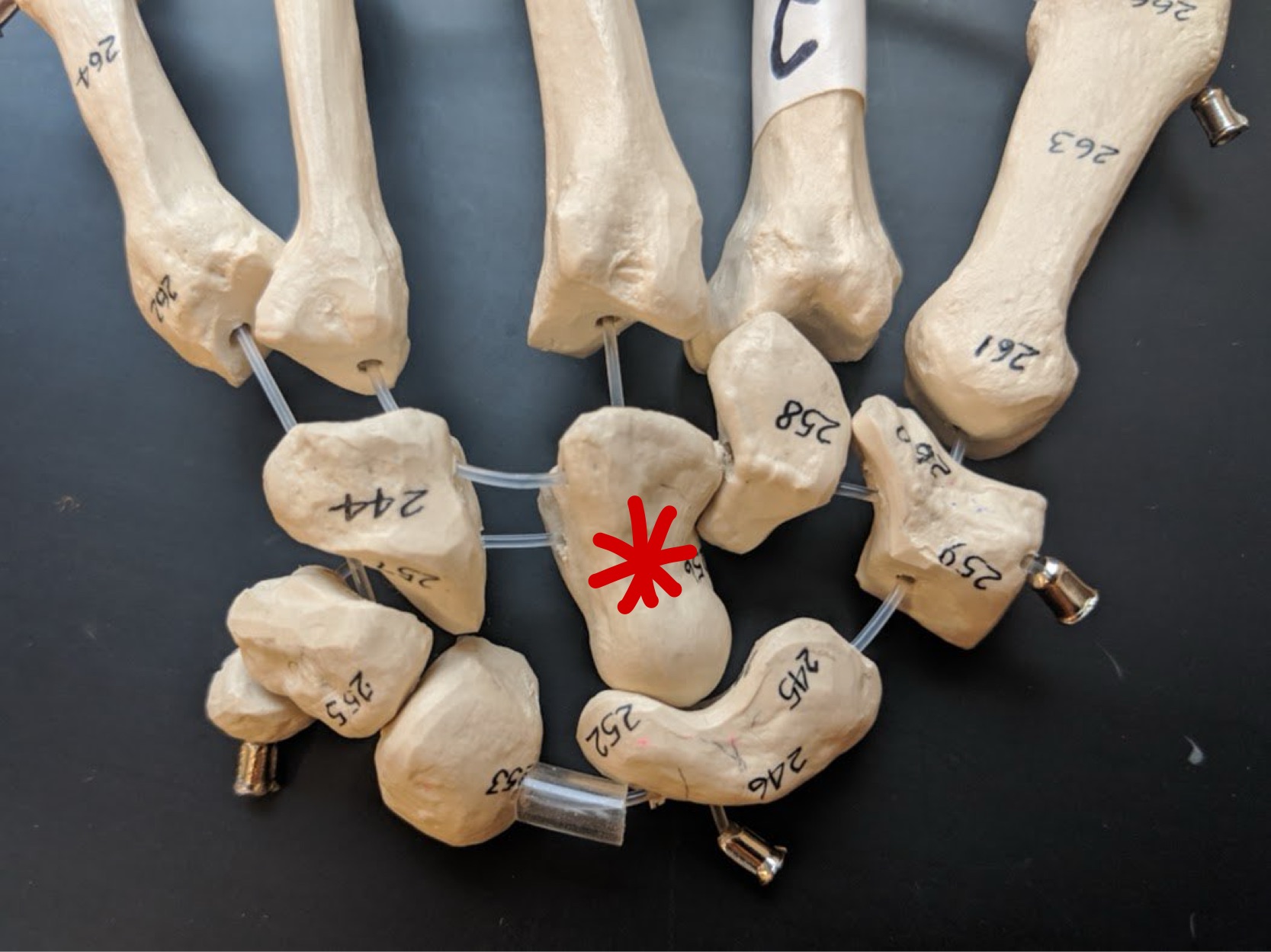 <p>Name this bone</p>