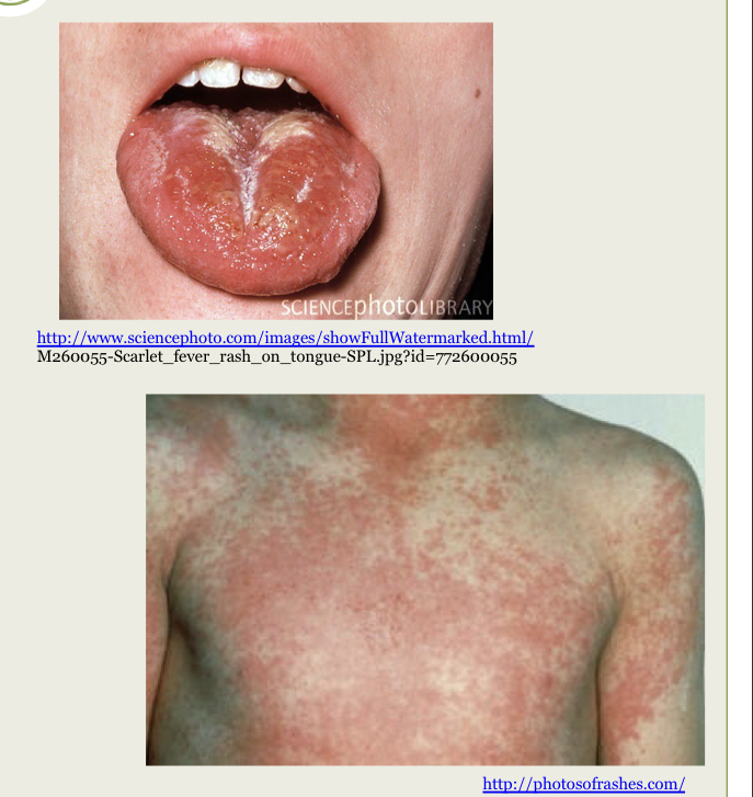 What infection is this?