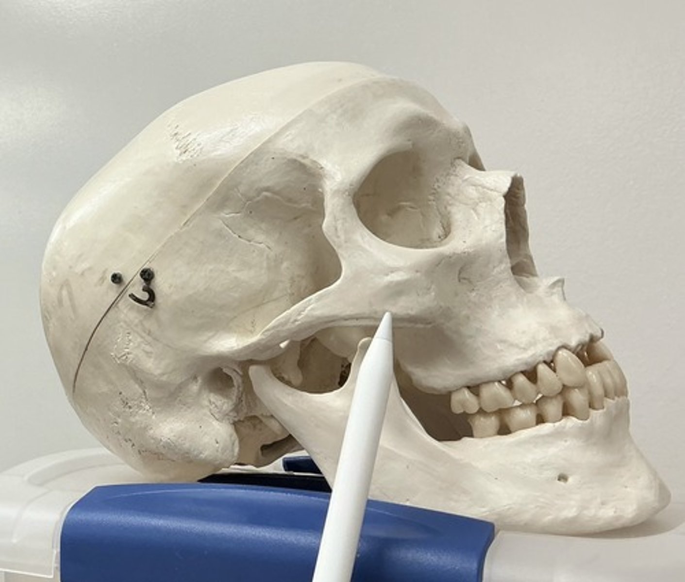 <p>What is the arrow pointing to?</p>