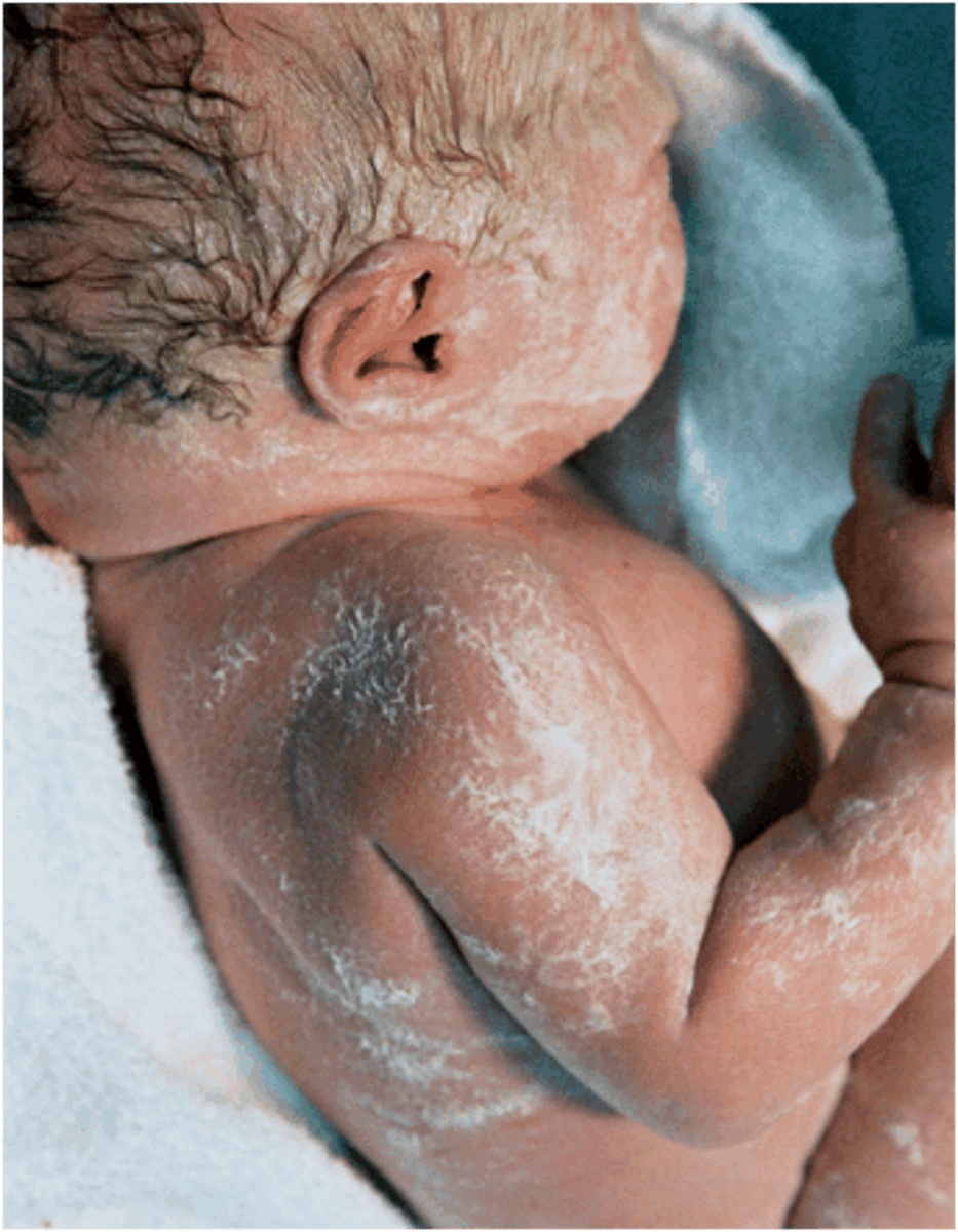 <p>A thick cheesy substance found coating the skin of newborns.</p>