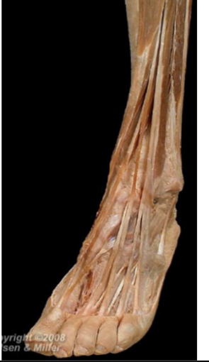 <p>Extensor Hallucis brevis</p>