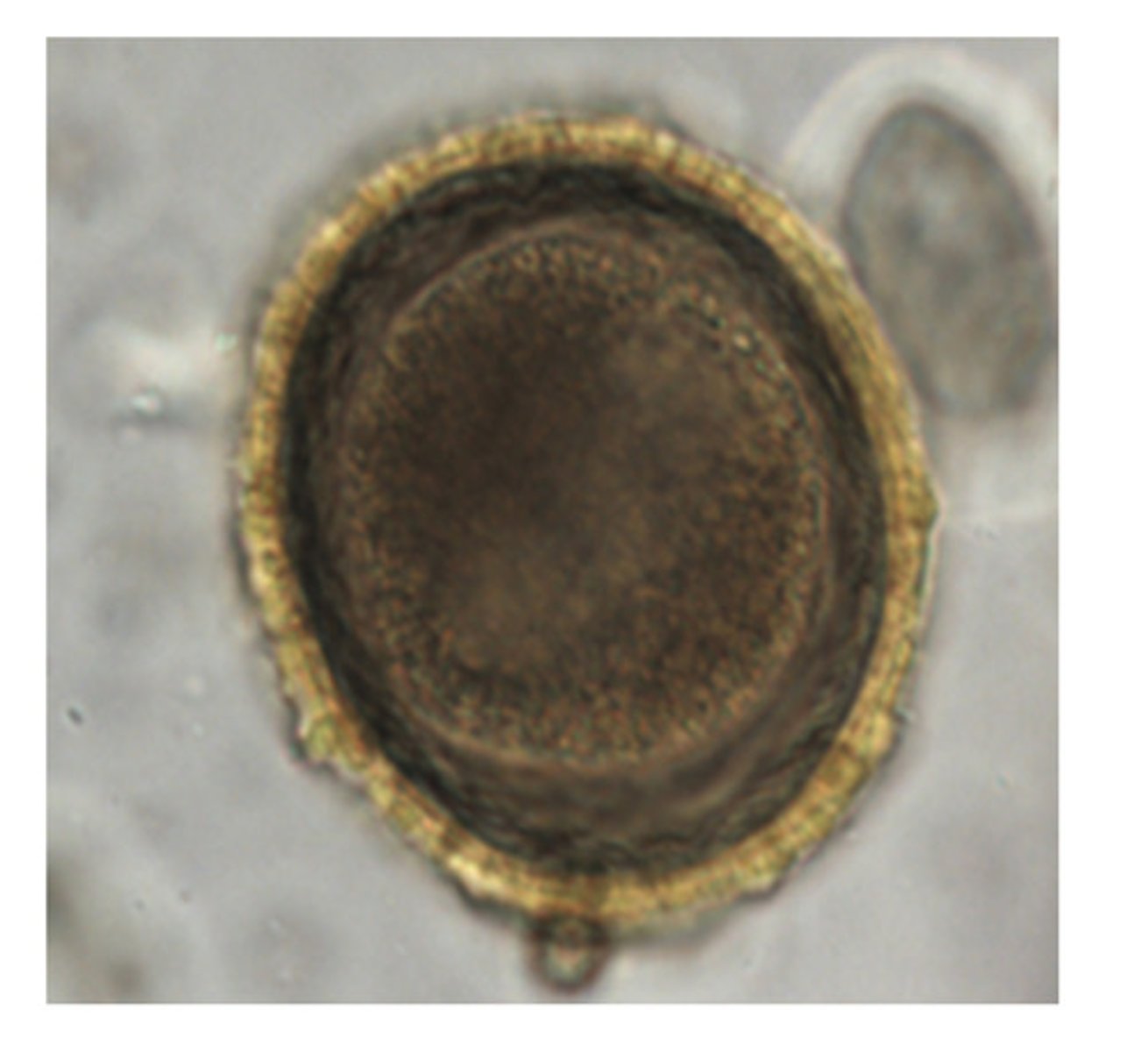 <p>This "roundworm" can be seen in many species of animals but uses the raccoon as its definitive host</p>