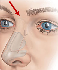 <p>dorsum nasi: root</p>