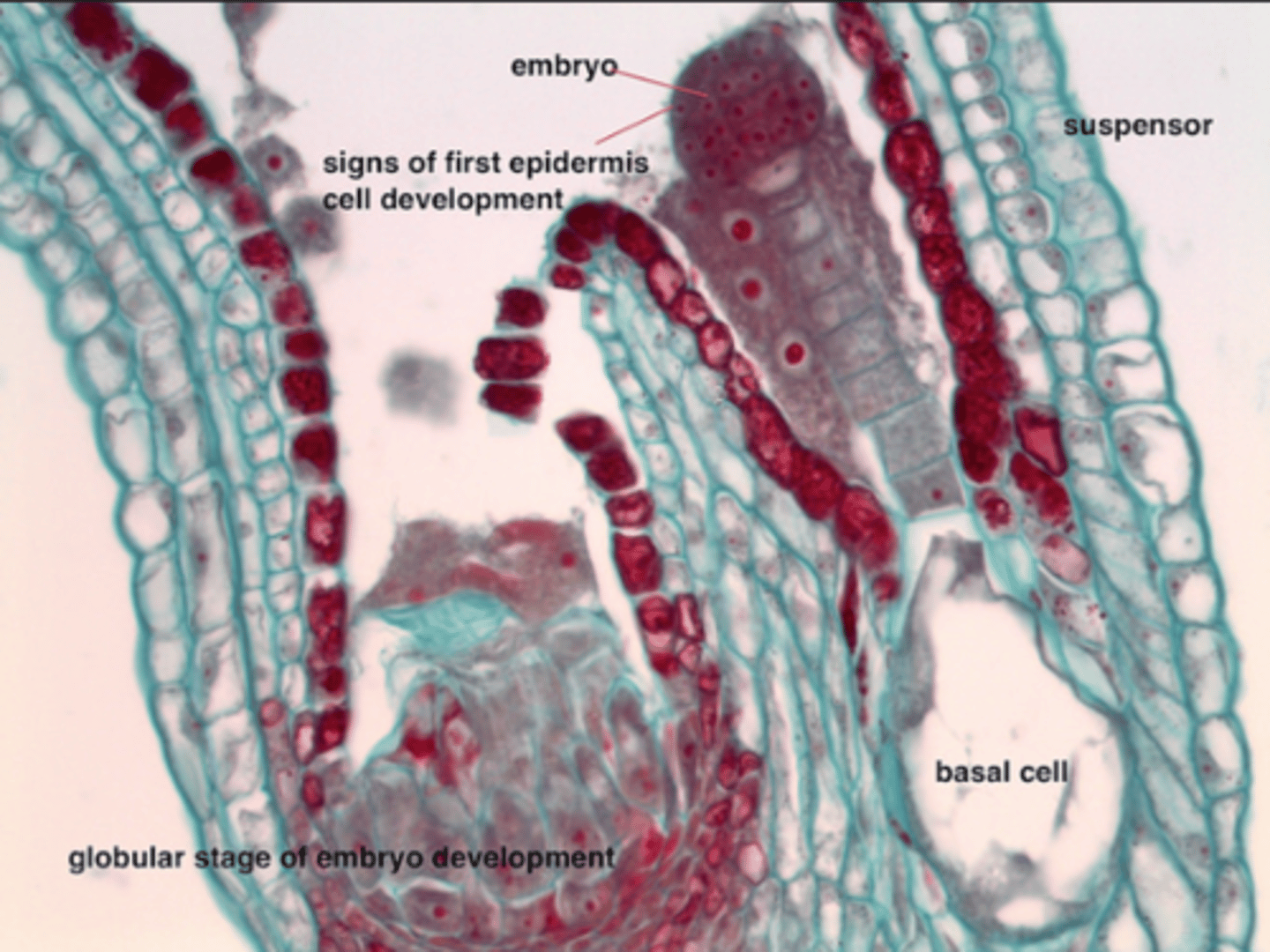 <p>tissue differentiation into protoderm, ground meristem, procambium; suspensor is 2 cells, initiation of protoderm</p>