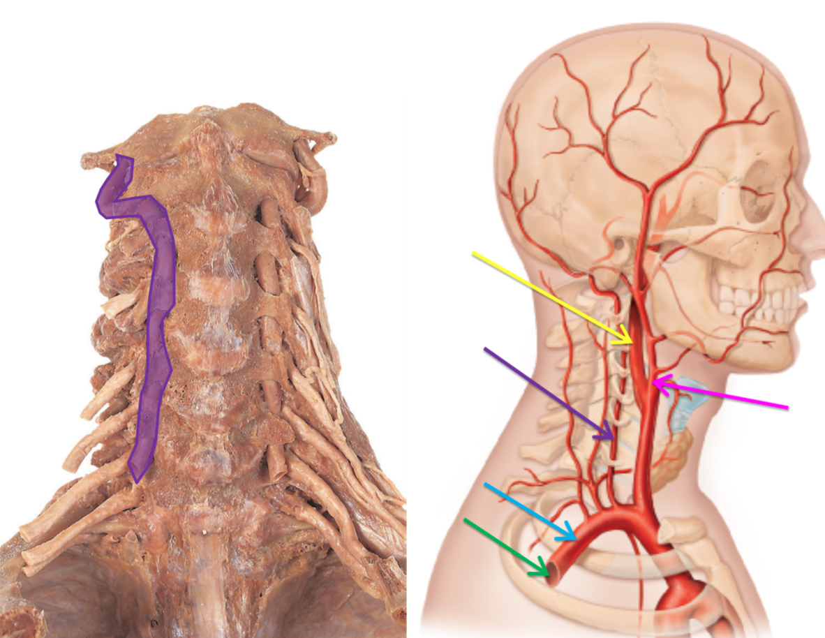 <p>What artery is highlighted purple? </p>