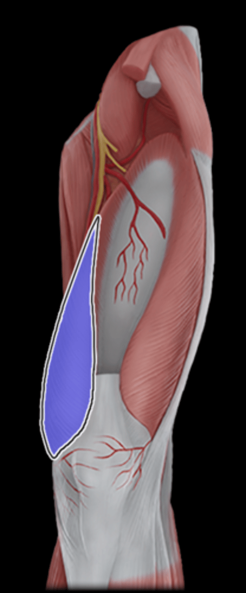 <p>What Muscle Is Highlighted?</p>