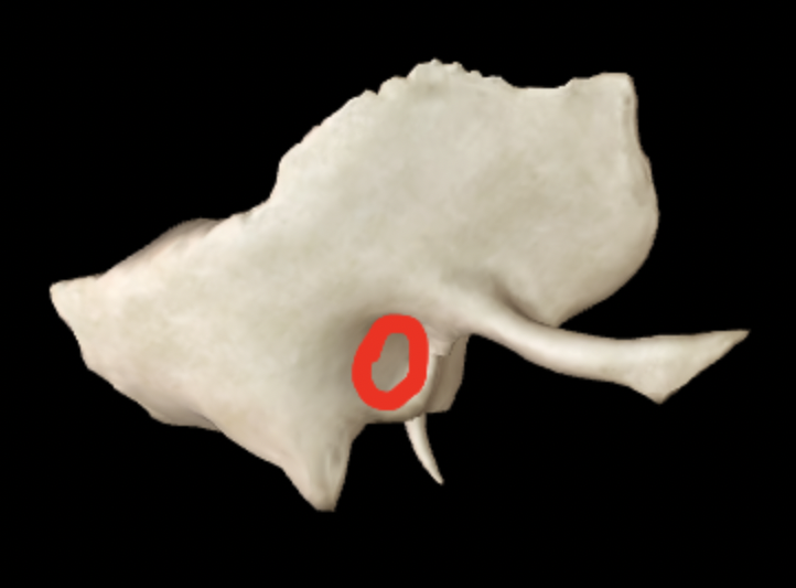 <p>What part of the temporal bone is this?</p>