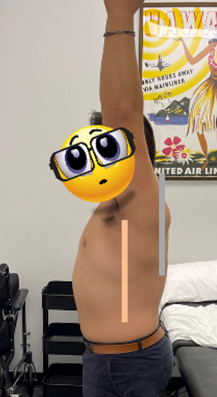 <p>Mid-Axillary Line</p>